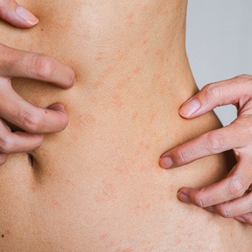 itchy skin