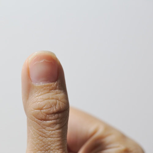 nail changes